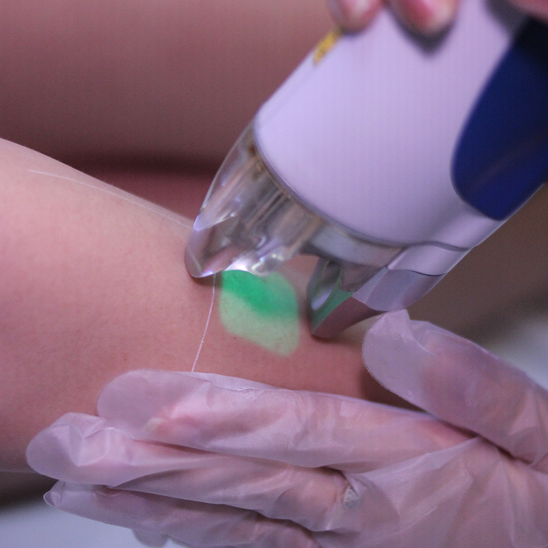 Vialaser - Clínica North Shopping 5